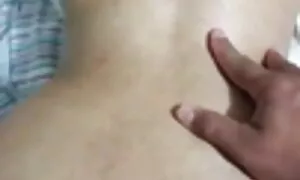 kwi-anal prolapse um ...